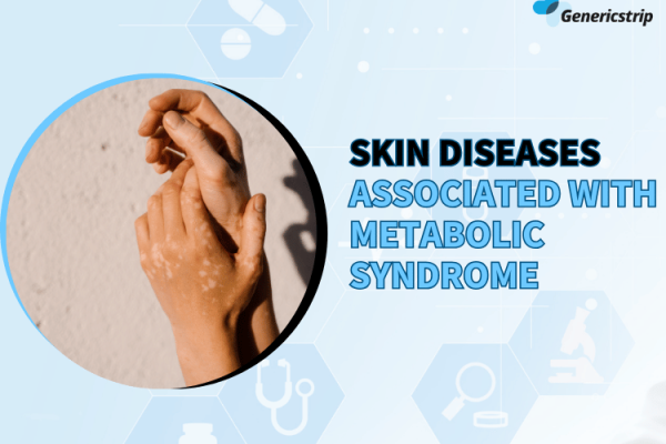 Skin Diseases